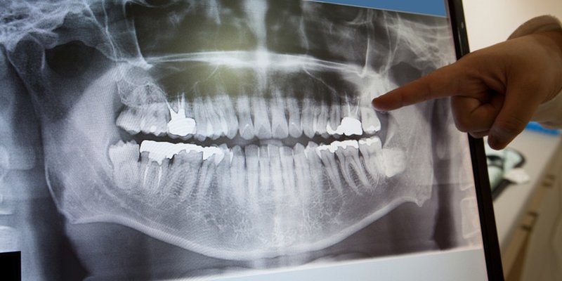 Dental France - Clinica dentara pentru adulti si copii, Voluntari