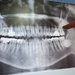 Dental France - Clinica dentara pentru adulti si copii, Voluntari